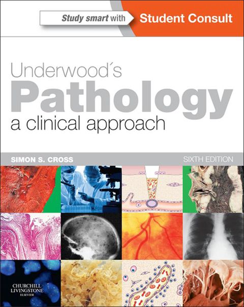 underwoods pathology a clinical approach with student consult access 6th edition cross md frcpath, simon s.