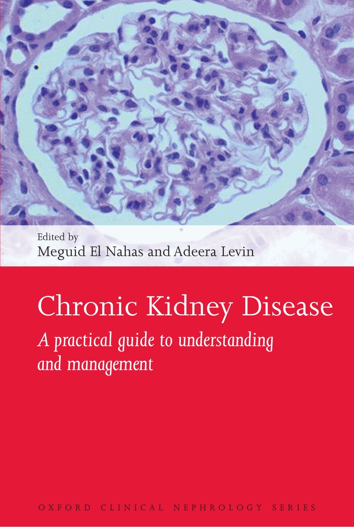 chronic kidney disease a practical guide to understanding and management 1st edition el nahas, meguid, levin,