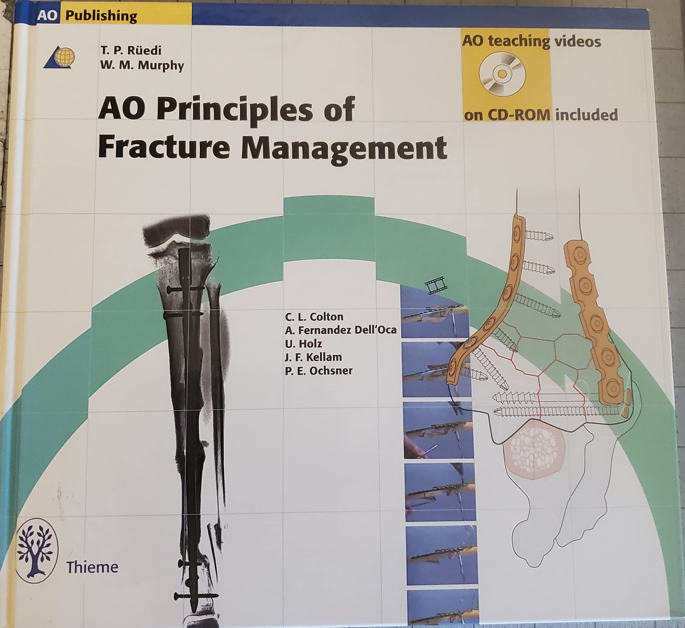ao principles of fracture management  ruedi, thomas p., murphy, william m. 0865778868, 9780865778863