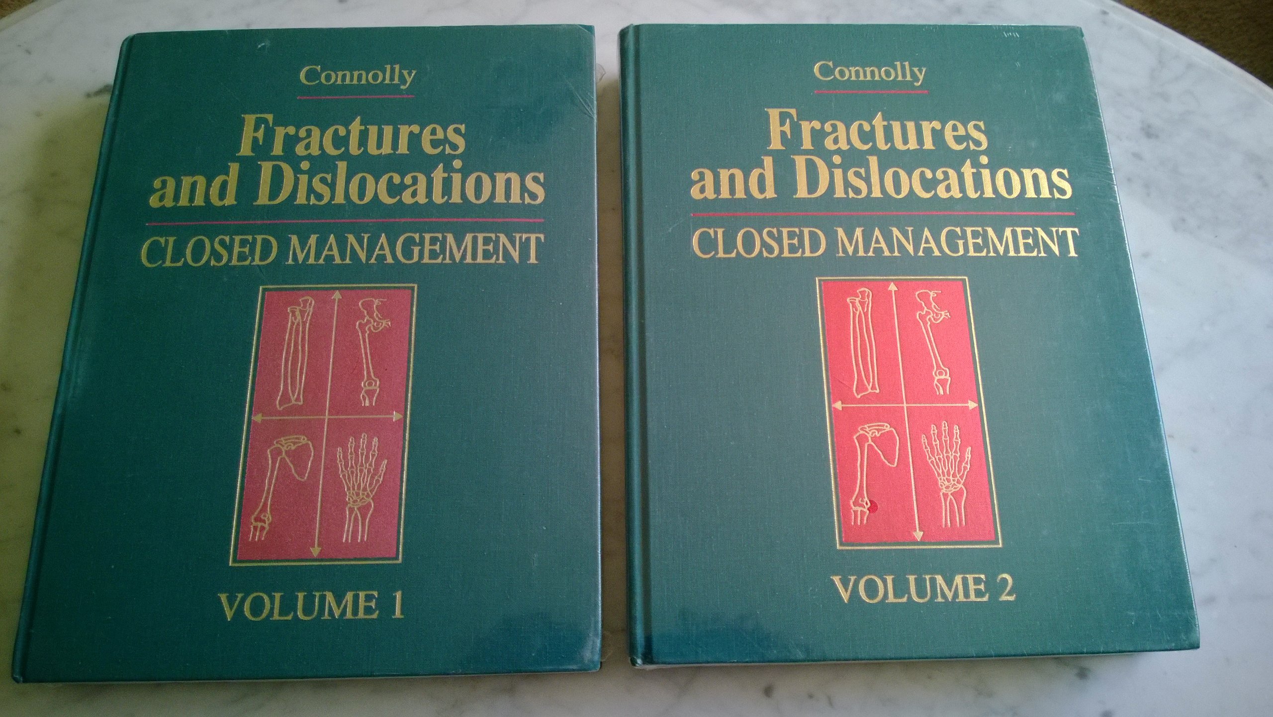 fractures and dislocations closed management connolly md, john f. 0721626017, 9780721626017