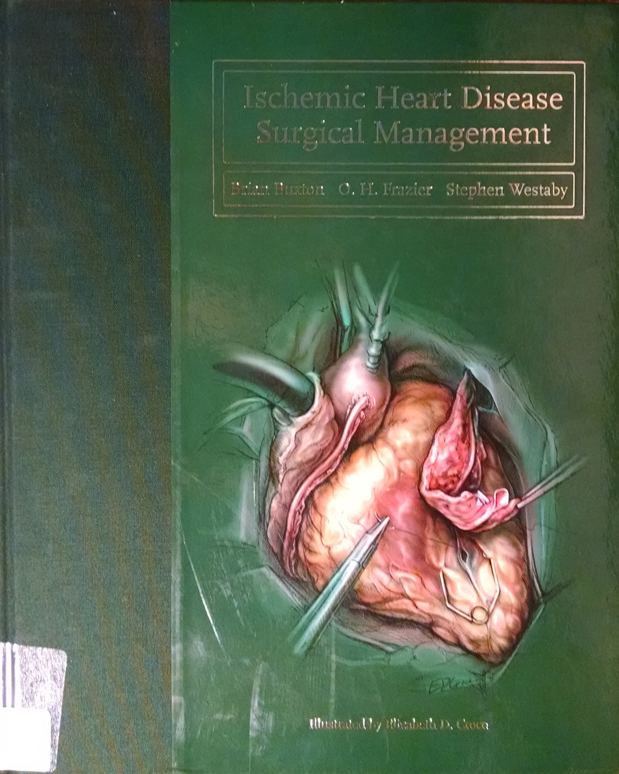 ischemic heart disease surgical management buxton mb bs fracs frcs ms facs, brian, frazier md, o.