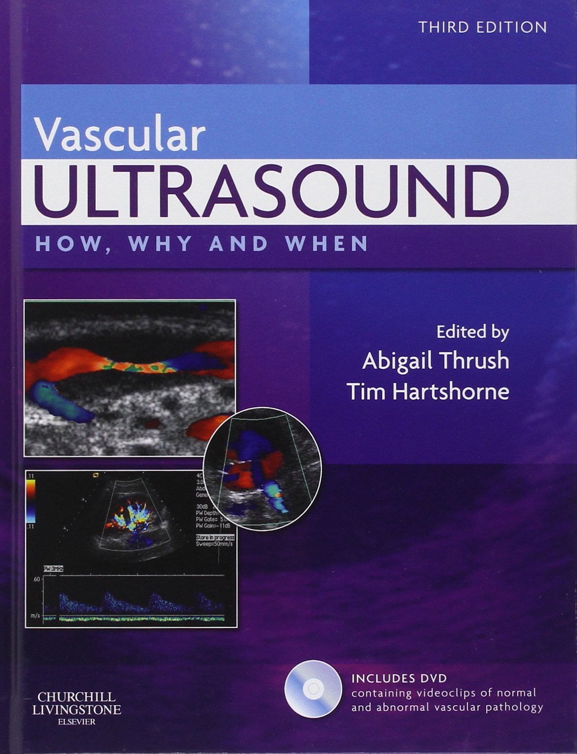 vascular ultrasound how why and when 3rd edition thrush bsc(physics)  msc(medical physics)  mipem (member of
