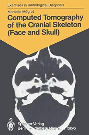 computed tomography of the cranial skeleton 58 radiological exercises for students and practitioners 1st