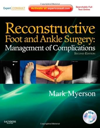 reconstructive foot and ankle surgery management of complications expert consult online print and dvd 2nd