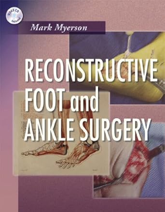 reconstructive foot and ankle surgery with dvd rom expert consult online print and dvd 1st edition mark s