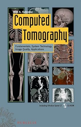 computed tomography fundamentals system technology image quality applications 2nd edition willi a kalender