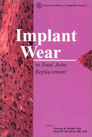 implant wear in total joint replacement clinical and biologic issues material and design considerations
