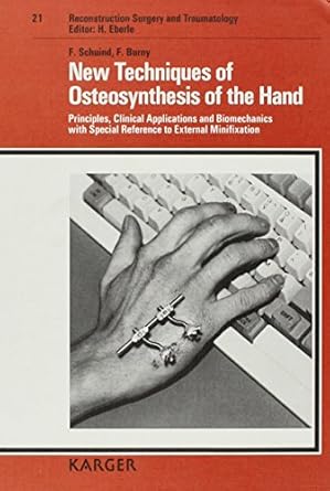 new techniques of osteosynthesis of the hand principles clinical applications and biomechanics with special