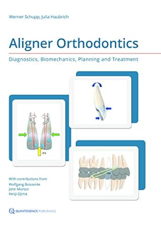aligner orthodontics diagnostics biomechanics planning and treatment 1st edition werner schupp ,julia