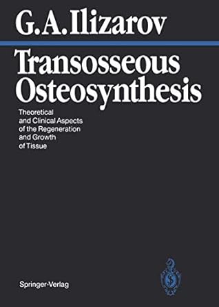 transosseous osteosynthesis theoretical and clinical aspects of the regeneration and growth of tissue 1st
