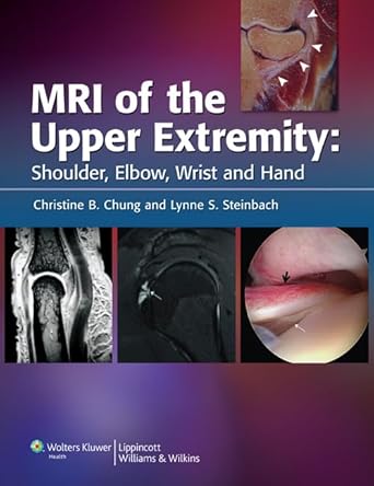 mri of the upper extremity shoulder elbow wrist and hand 1st edition christine b chung md ,lynne s steinbach