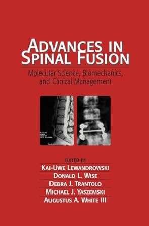 advances in spinal fusion molecular science biomechanics and clinical management 1st edition kai uwe