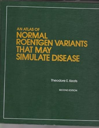 an atlas of normal roentgen variants that may simulate disease 1st edition theodore e keats 0815150075,