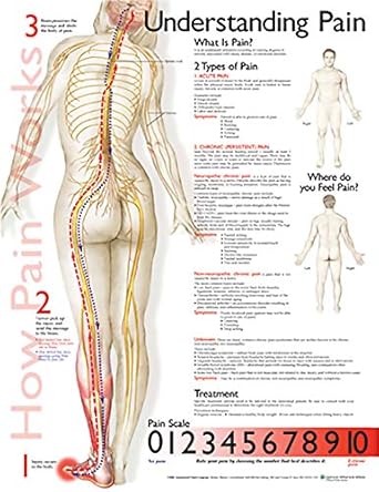 understanding pain anatomical chart 1st edition anatomical chart company 1587799847, 978-1587799846