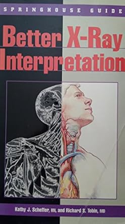 better x ray interpretation 1st edition kathy j scheffer ,richard s tobin 0874348684, 978-0874348682