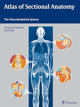 atlas of sectional anatomy the musculoskeletal system 1st edition torsten bert moller ,emil reif 3131465417,