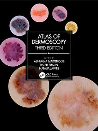 atlas of dermoscopy 1st edition ashfaq a marghoob ,ralph braun ,natalia jaimes 1138595985, 978-1138595989