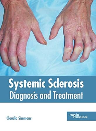 systemic sclerosis diagnosis and treatment 1st edition claudia simmons 1632416417, 978-1632416414
