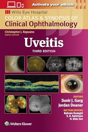 uveitis 1st edition sunir j garg md 1975215192, 978-1975215194