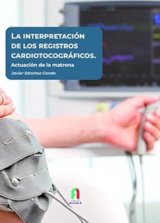 la interpretacion de los registros cardiotocograficos 1st edition javier sanchez conde 8418980117,
