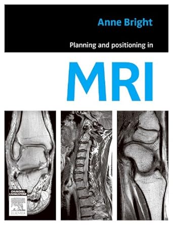 planning and positioning in mri 1st edition anne bright 0729539857, 978-0729539852
