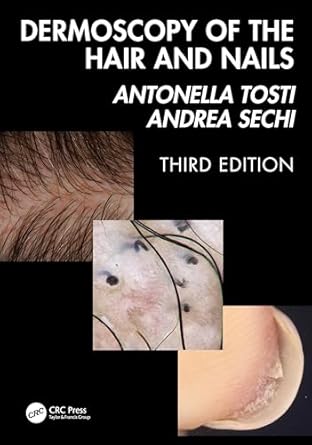 dermoscopy of the hair and nails 3e 1st edition antonella tosti ,andrea sechi 1041020023, 978-1041020028