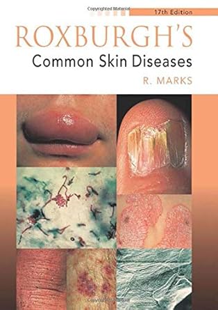 roxburghs common skin diseases 1st edition ronald marks 0340762322, 978-0340762325
