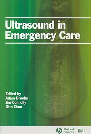 ultrasound in emergency care 1st edition adam brooks ,jim connolly ,otto chan 0727917315, 978-0727917317