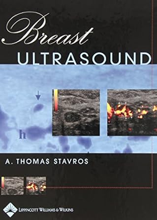 breast ultrasound 1st edition a thomas stavros md facr 039751624x, 978-0397516247