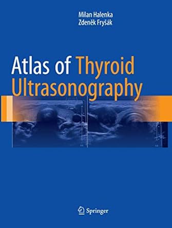 atlas of thyroid ultrasonography 1st edition milan halenka ,zdenek frysak 331985237x, 978-3319852379