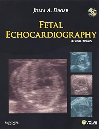 fetal echocardiography 1st edition julia a drose ba rdms rdcs rvt 1416056696, 978-1416056690