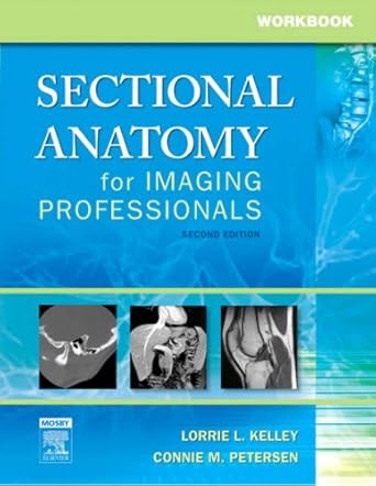 workbook for sectional anatomy for imaging professionals 1st edition lorrie l kelley ms rt ,connie petersen
