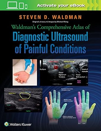waldmans comprehensive atlas of diagnostic ultrasound of painful conditions 1st edition steven waldman