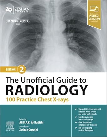the unofficial guide to radiology 100 practice chest x rays 1st edition ali b a k al hadithi mb bchir ma mrcp