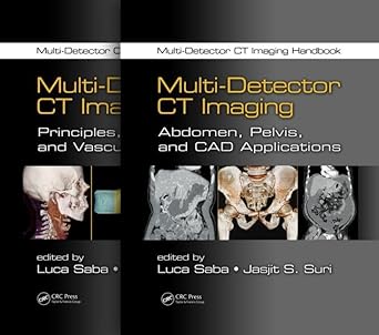 multi detector ct imaging handbook two volume set 1st edition luca saba ,jasjit s suri 1439893993,
