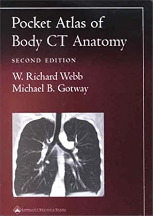 pocket atlas of body ct anatomy 1st edition w richard webb ,michael b gotway md 0781736633, 978-0781736633