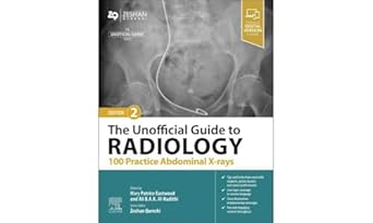 the unofficial guide to radiology 100 practice abdominal x rays 1st edition patrice eastwood ,ali b a k al