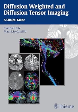 diffusion weighted and diffusion tensor imaging a clinical guide 1st edition claudia leite ,mauricio castillo