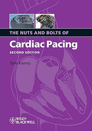 the nuts and bolts of cardiac pacing by kenny tom paperback 1st edition tom kenny 1405184035, 978-1405184038