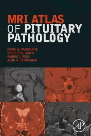 mri atlas of pituitary pathology 1st edition kevin m pantalone do ecnu ccd ,stephen e jones phd ,robert j
