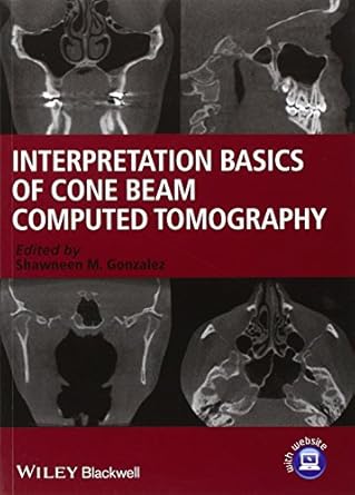 interpretation basics of cone beam computed tomography 1st edition shawneen m gonzalez 1118381068,
