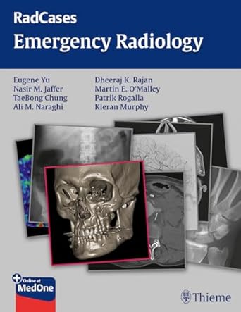 radcases emergency radiology 1st edition eugene yu ,nasir jaffer ,taebong chung ,ali m naraghi ,dheeraj rajan