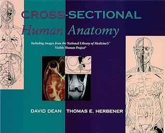 cross sectional human anatomy 1st edition david dean phd ,thomas e herbener md 0683303856, 978-0683303858