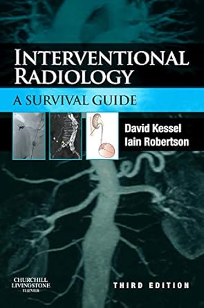 interventional radiology a survival guide 1st edition david kessel mb bs ma mrcp frcr ebir ,iain robertson mb