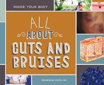 all about cuts and bruises 1st edition r n potts, francesca 1532111185, 978-1532111181