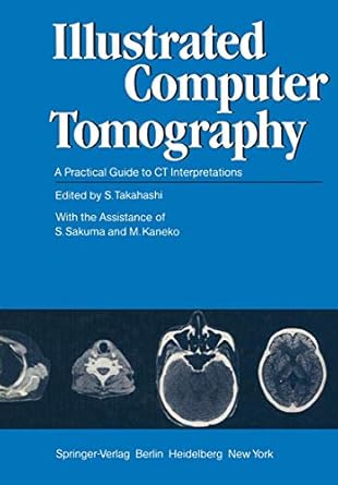 illustrated computer tomography a practical guide to ct interpretations 1st edition s takahashi 3540114327,