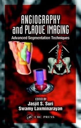 angiography and plaque imaging advanced segmentation techniques 1st edition jasjit s suri ,swamy laxminarayan