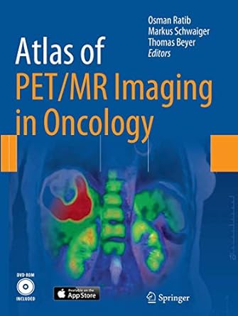 atlas of pet/mr imaging in oncology 1st edition osman ratib ,markus schwaiger ,thomas beyer 3662509954,