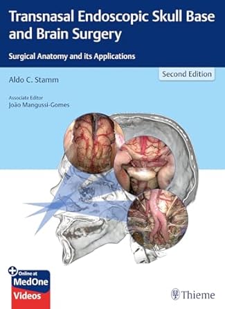 transnasal endoscopic skull base and brain surgery surgical anatomy and its applications 1st edition aldo c