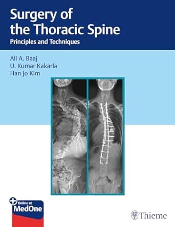 surgery of the thoracic spine principles and techniques 1st edition ali a baaj ,u kumar kakarla ,han jo kim